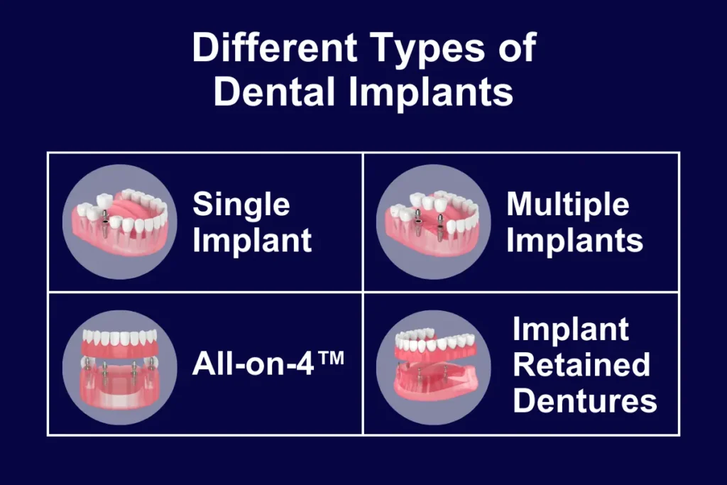 The image is an educational graphic that outlines the different types of dental implants available. There are four circular insets against a dark blue background, each depicting a different dental implant scenario. The top left shows a 'Single Implant' with one crown, the top right displays 'Multiple Implants' supporting several crowns. The bottom left illustrates the 'All-on-4™' technique where a full arch of teeth is supported by four implants, and the bottom right is labelled 'Implant Retained Dentures', indicating a full denture anchored by implants. Text above the graphics reads "Different Types of Dental Implants".